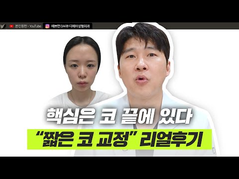 짧은 코 교정, 실제 케이스로 확인해보세요! ㅣ디에이성형외과