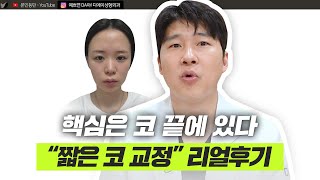 짧은 코 교정, 실제 케이스로 확인해보세요! ㅣ디에이성형외과
