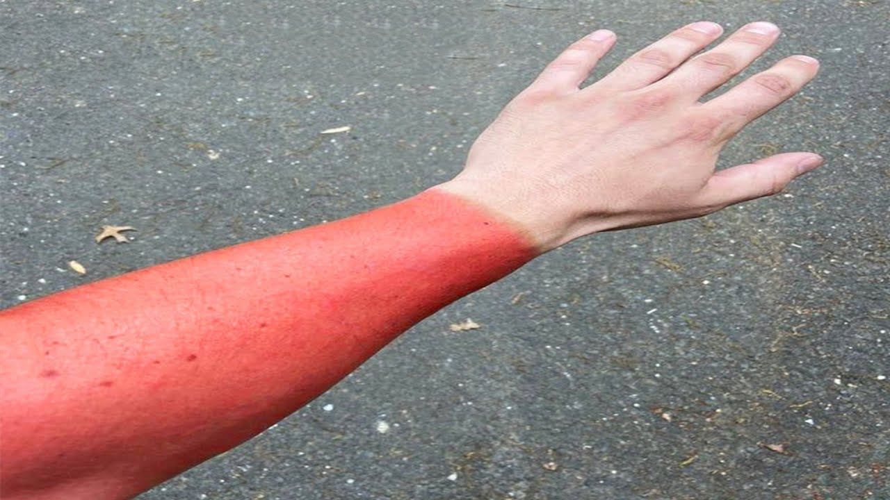 THE BEST OF r/WELLTHATSUCKS