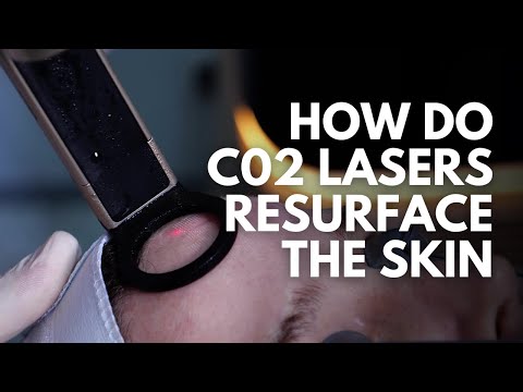 Fractional CO2 Laser Explained: How It Works, Benefits & Why Precision Matters