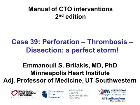 Case 39: Manual of CTO Interventions - Perfect storm!