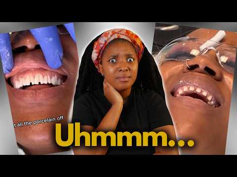 Scammed into being a VENEER TECH