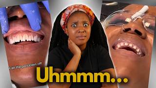 Scammed into being a VENEER TECH MQDEFAULT Thumbnail