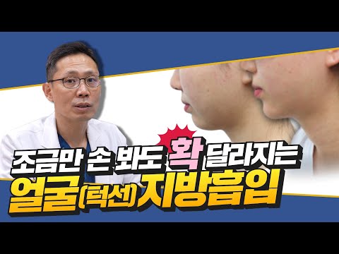 얼굴 지방흡입 고민만 하고 계신가요? 아무리 다이어트해도 이중턱은 안 빠지시나요?