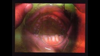 HUNGER FARM – Motion/ Cure for cancer (Alternative rock, energetic, Usa)