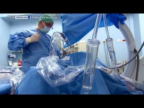 Strephexopodia leczenie u dorosłych Operacja palucha koślawego Moskwa