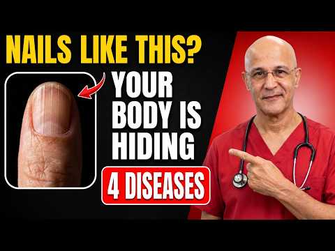 Neurologist Warns: If Your NAILS Look Like THIS After 60, Your Body May be Hiding 4 Diseases|Mandell
