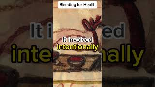 Bleeding for Health | The Curious Practice of Bloodletting #Bloodletting #BalanceAndBlood #medical