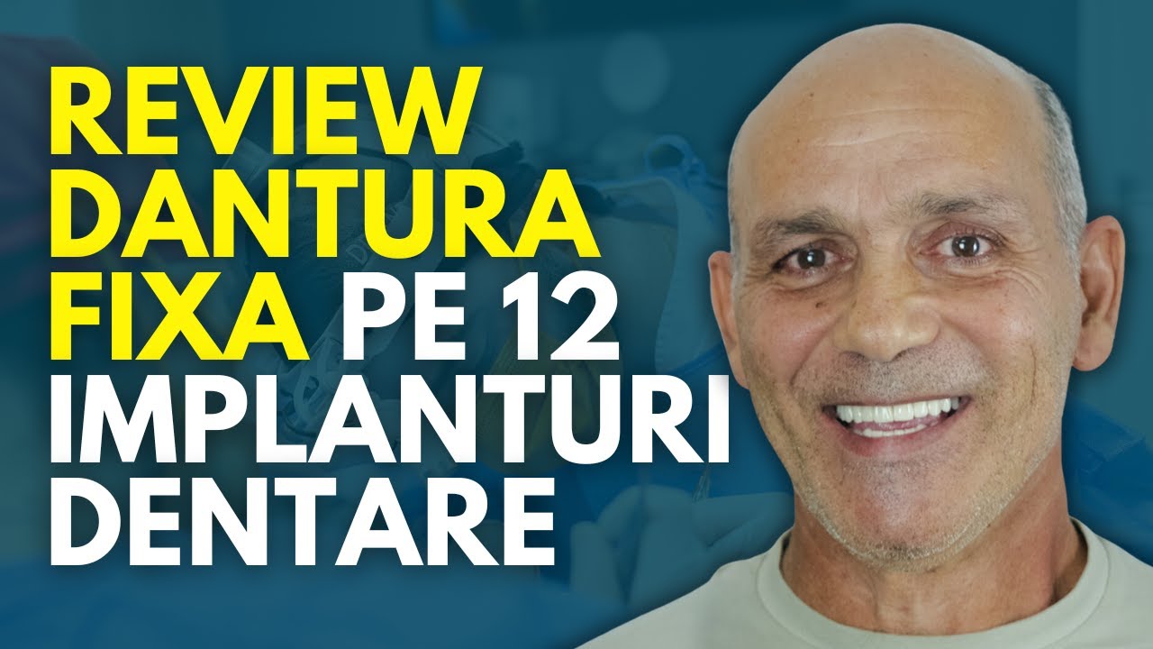 Refacere Completa a Danturii pe 12 Implanturi (6 Implanturi la Maxilar, 6 Implanturi la Mandibula)