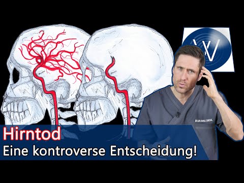 Brain death: What exactly does it mean & is it truly irreversible? My body is healthy, but my bra...