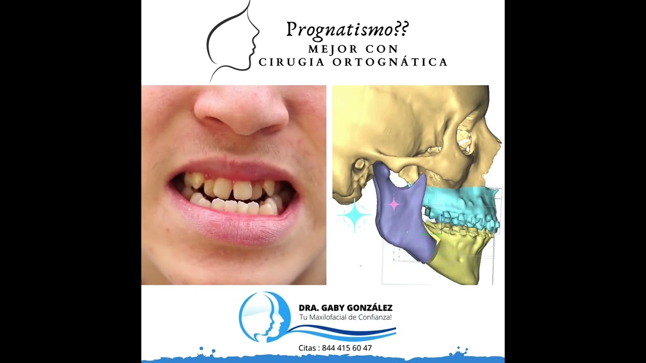 Laura Gabriela González Valdéz-68