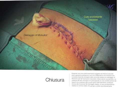 Torcicollo alla base Radiografie della colonna cervicale di prezzo due risalti