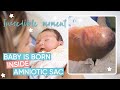 Incredible En Caul Birth | Channel Mum