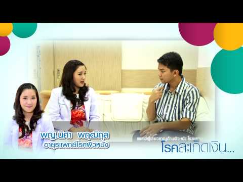 โรคผิวหนังภูมิแพ้ผิวหนังตกสะเก็ดอย่างยิ่ง วิธีการรักษาโรคสะเก็ดเงินในเด็ก