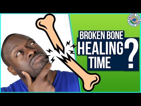 Fractured Bone Healing Time