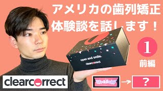 [アメリカ生活] マウスピース歯列矯正の体験談を話します！-前編- "Clear Correct (クリアコレクト) 体験記 ①" 043
