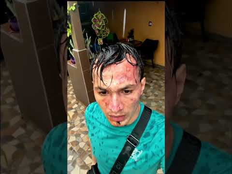 😰😰😰 #supreme #hoodie #balaclava #balaclava