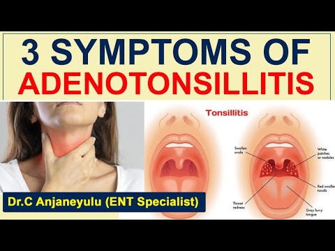 What Causes Adenotonsillitis in Children? | Tonsillitis | Dr C Anjaneyulu | Socialpost Healthcare
