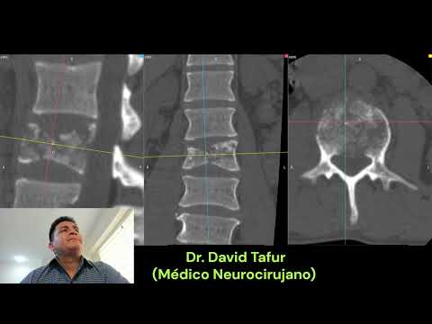 David Tafur Muñoz-3530