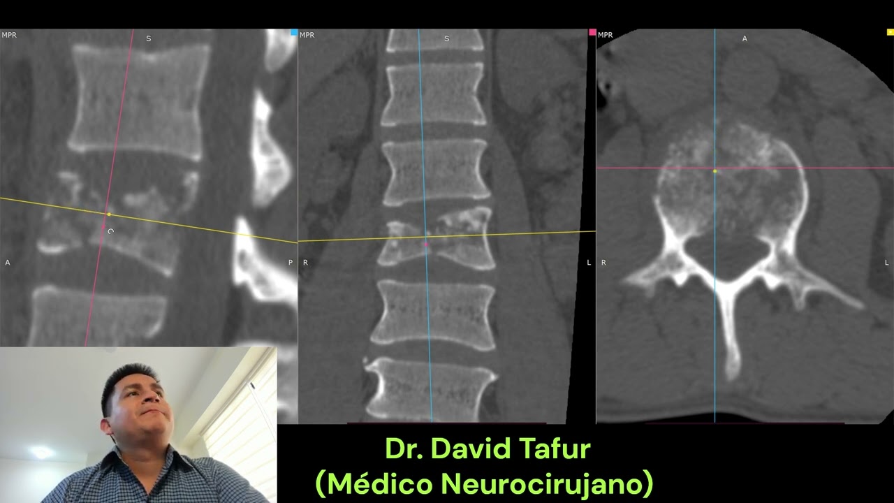 David Tafur Muñoz-2464