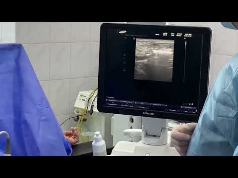 Відео — ЕВЕЗ