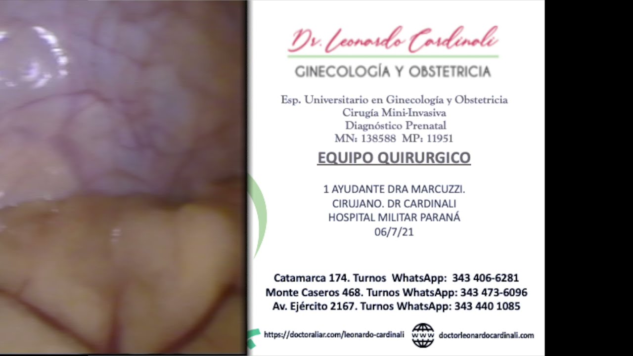 Leonardo Cardinali-19