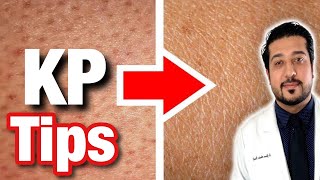 How to Get Rid of KP Bumps on ARMS | Keratosis Pilaris Treatment ✅