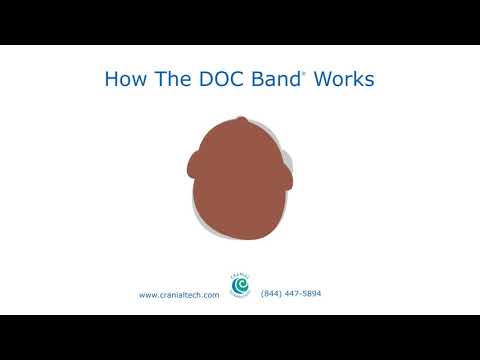 How The DOC Band® Works