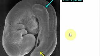 Desarrollo de las extremidades - Parte 1