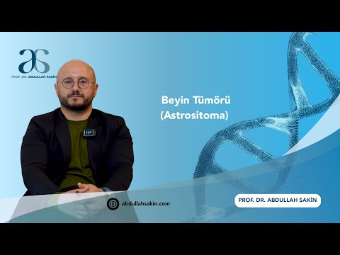 ASTROSİTOMA (BEYİN KANSERİ) NEDİR? HAKKINDA BİLMENİZ GEREKENLER