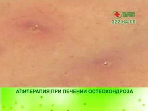Что делать при болях ниже поясницы Лечат суставы подмором