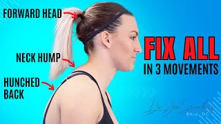 I Fixed My Neck Hump And Forward Head Posture In 30 Days! thumbnail