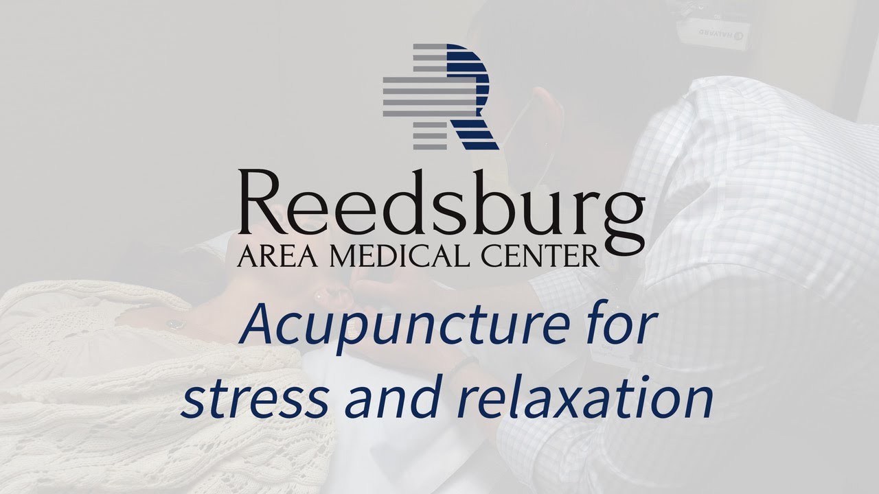 Acupuncture for stress and relaxation