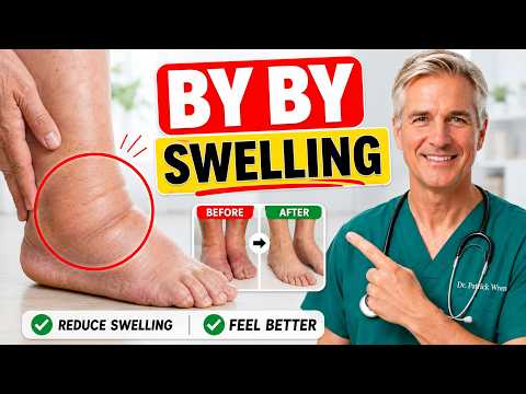 Doctor Reveals: 5 Exercises That STOP Leg Swelling After 60 | Dr Patrick Wren