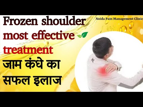 Most effective treatment of Frozen Shoulder.