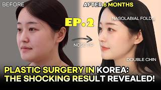 From China to Korea for THIS Surgery! Ep.2