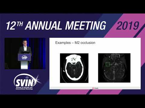 SVIN 2019: VizAI: Role in LVO Detection and Stroke Performance Metrics (Non-CME)
