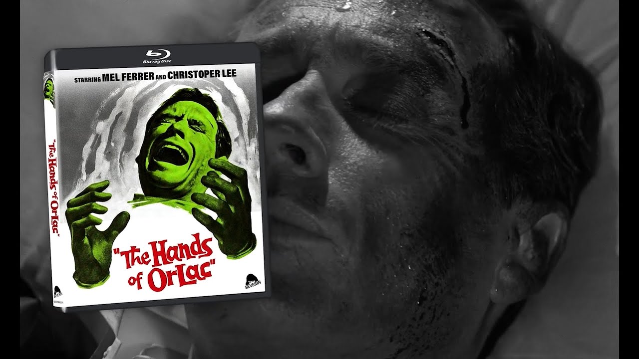 Miniature de la vidéo Trailer du film Les Mains d'Orlac