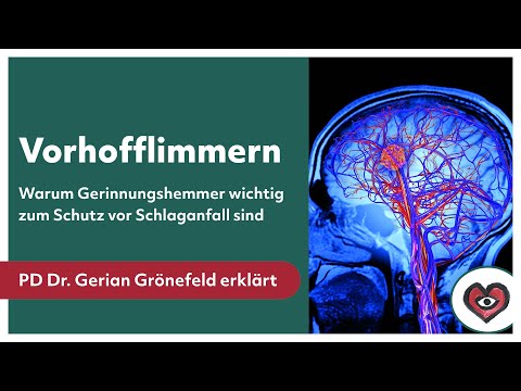 Vorhofflimmern: Warum Gerinnungshemmer wichtig zum Schutz vor Schlaganfall sind
