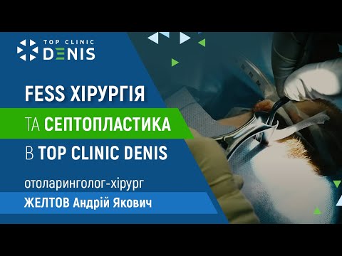 FESS хирургия и септопластика - TOP Clinic DENIS