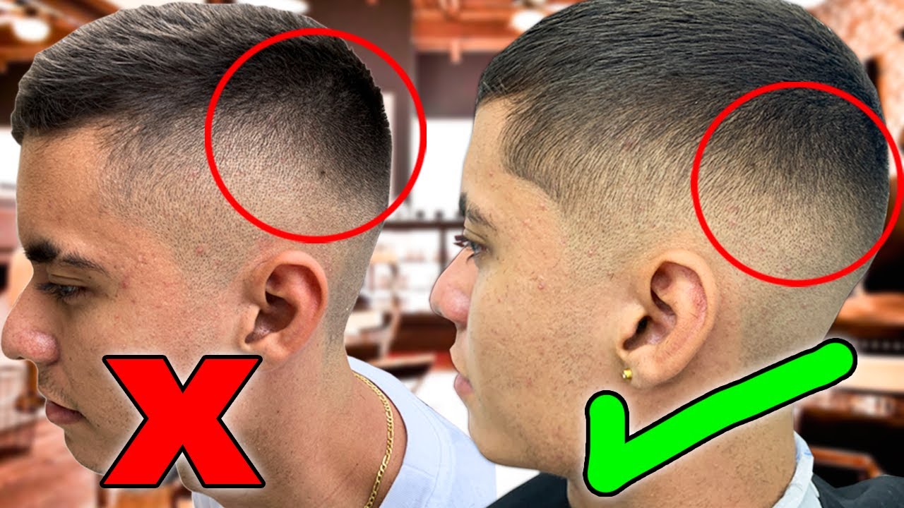 Watch MUCHO CUIDADO CON LOS PARCHES OSCUROS EN LA CABEZA ESTA ES LA SOLUCION 🤯🔥 Now MUCHO CUIDADO CON LOS PARCHES OSCUROS EN LA CABEZA ESTA ES LA SOLUCION 🤯🔥