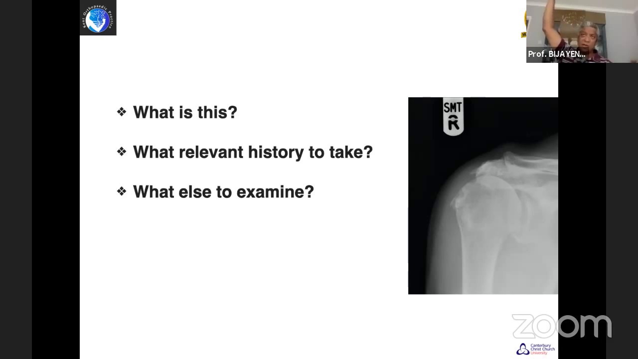 Shoulder topics for the Fellowship Exam