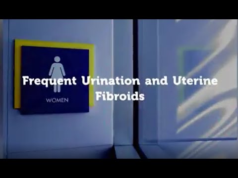 Uterine Fibroids and Frequent Urination