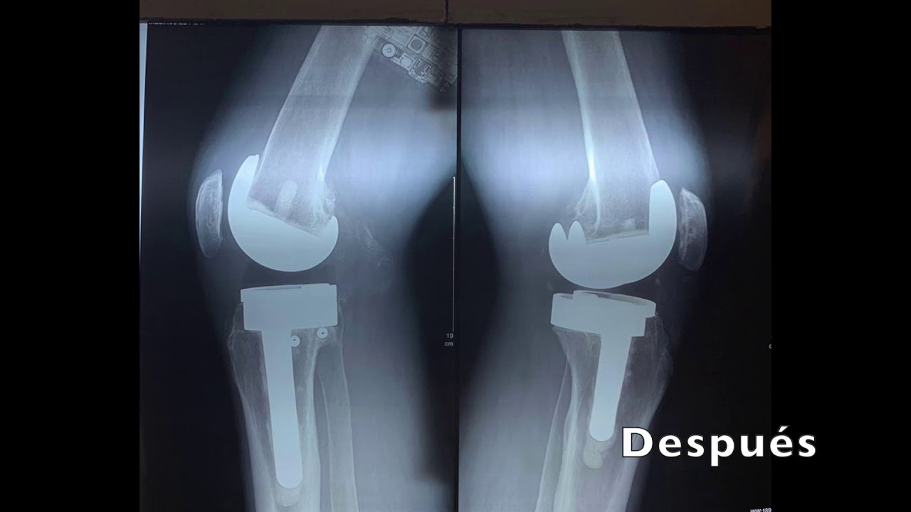 Artemio González Sánchez-10