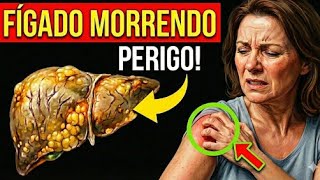 DOR no OMBRO? É o FÍGADO Gritando por SOCORRO (13 Sinais de Dano Hepático)
