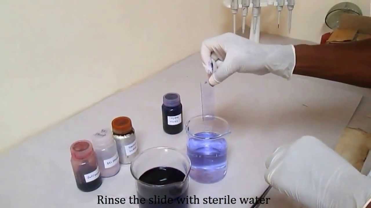 Gram staining for differentiating bacterial species