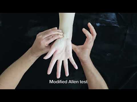 Allen Test, Modified Allen Test and Digital Allen Test - Supplementary Video 1