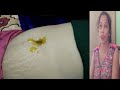 नाभि से ठीक करे वायु गोला गैस का गोला क�