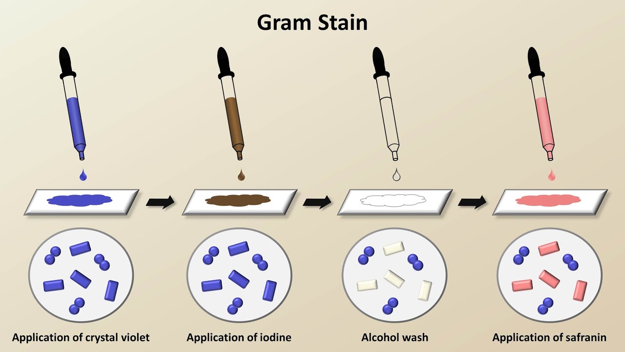 Classification of Bacteria (Antibiotics - Lecture 1)