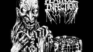 MEATHOLE INFECTION  -  Pulsating Sores